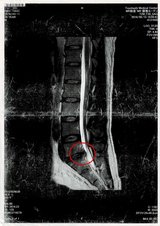 修正：MRI①